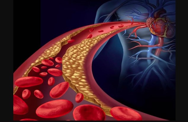हाई कोलेस्ट्रॉल बन रहा युवाओं की बड़ी परेशानी, किचन की ये गलतियां बढ़ा रही हैं खतरा